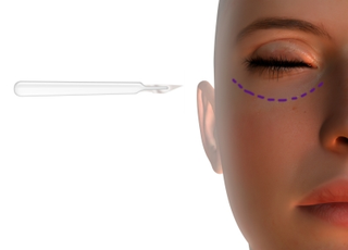 Illustration for article titled Ladies Could Enhance Their Physical Appearance With A Surgical Procedure